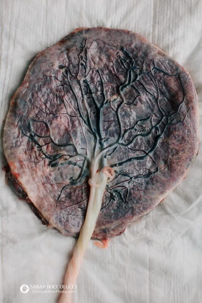 human placenta and fetus